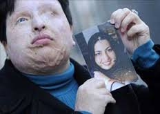 اسید پاشی؛اسم رمز حمله به امر به معروف و نهی ازمنکر