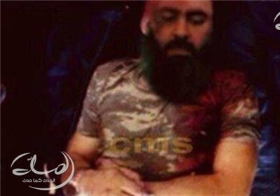 نخستین تصویر «ابوبکر البغدادی» سرکرده داعش پس از مجروح شدن