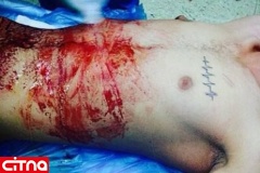 حادثه‌ای شرم آور در جامعه پزشکی؛ اینستاگرام بازی با بدن بیمار +عکس