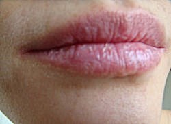 چگونه از‌ خشکی لب‌ها جلوگیری‌ کنیم؟