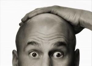 آیا ریزش مو وراثتی است؟