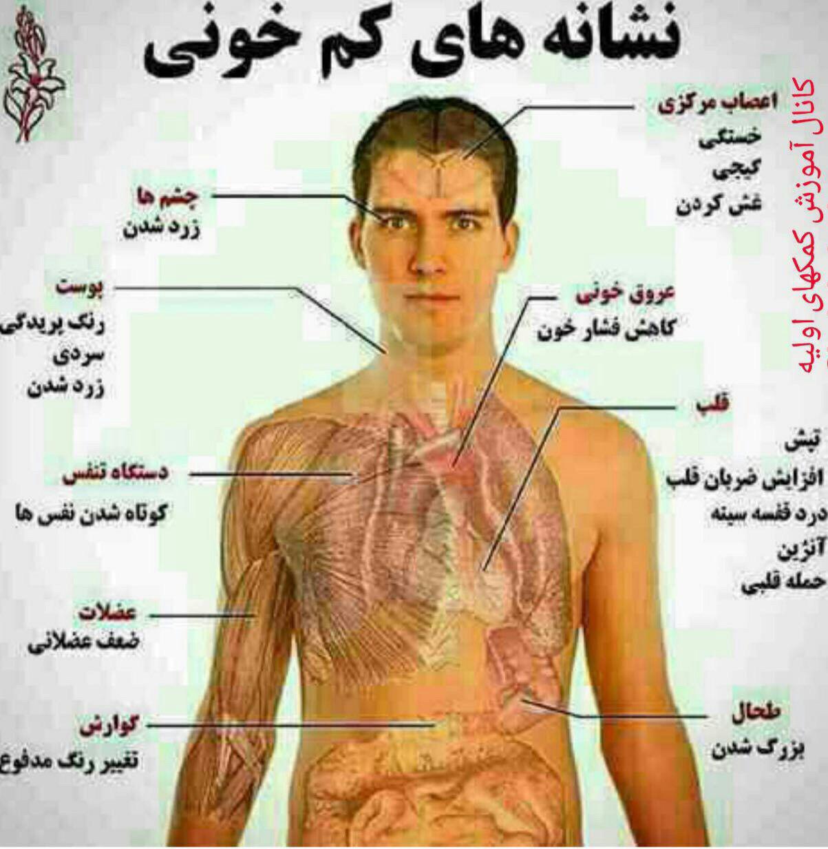 نشانه‌های کم خونی +عکس