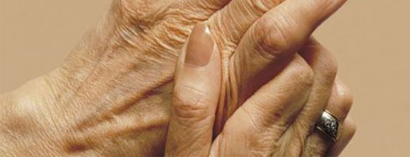چطور با درد همیشگی آرتروز زندگی کنیم؟