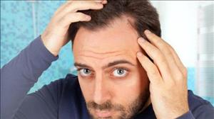 ۸ واقعیتی که موهای شما درباره سلامتی تان می گویند
