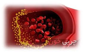چطور بفهمیم چربی خونمان بالاست؟