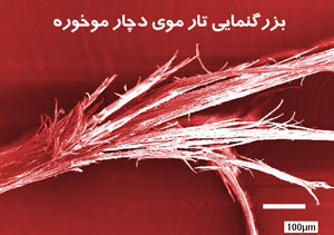 چگونه از موخوره جلوگیری کنیم؟