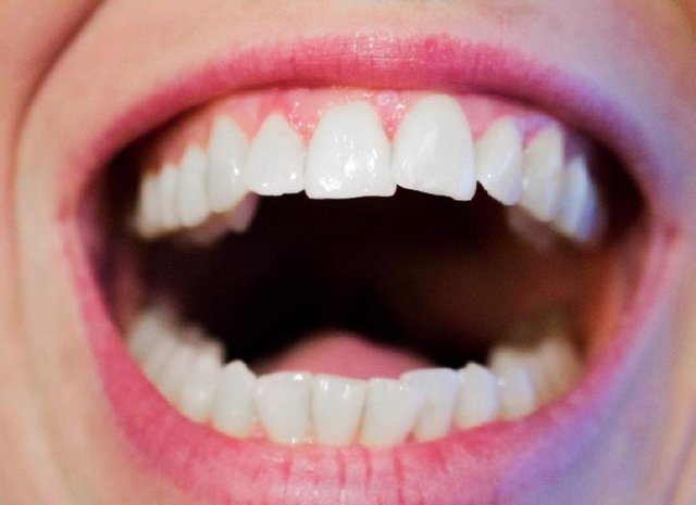 ۵ درمان خانگی برای پوسیدگی دندان‌