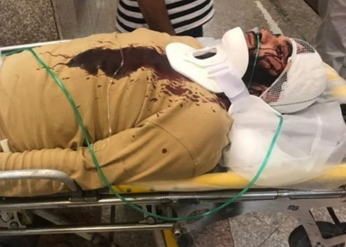 مدعیان آزادی چنان سکوت کرده‌اند که انسان فکر می‌کند لال هستند